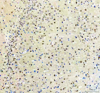 Immunohistochemical staining of SRRT using anti-SRRT antibody. SRRT was detected in a paraffin-embedded section of rat brain tissue. Heat mediated antigen retrieval was performed in EDTA buffer (pH 8.0, epitope retrieval solution). The tissue section was blocked with 10% goat serum. The tissue section was then incubated with 2 ug/ml rabbit anti-SRRT antibody overnight at 4oC. Peroxidase Conjugated Goat Anti-rabbit IgG was used as secondary antibody and incubated for 30 minutes at 37oC. The tissue section was developed using an HRP secondary and DAB substrate.