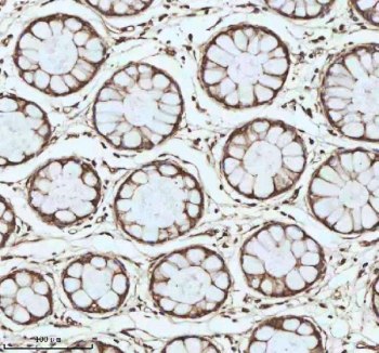 Immunohistochemical staining of MYH14 using anti-MYH14 antibody. MYH14 was detected in a paraffin-embedded section of human colon tissue. Heat mediated antigen retrieval was performed in EDTA buffer (pH 8.0, epitope retrieval solution). The tissue section was blocked with 10% goat serum. The tissue section was then incubated with 2 ug/ml rabbit anti-MYH14 antibody overnight at 4oC. Peroxidase Conjugated Goat Anti-rabbit IgG was used as secondary antibody and incubated for 30 minutes at 37oC. The tissue section was developed using an HRP secondary and DAB substrate.