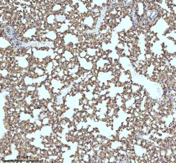 Immunohistochemical staining of MYH14 using anti-MYH14 antibody. MYH14 was detected in a paraffin-embedded section of mouse lung tissue. Heat mediated antigen retrieval was performed in EDTA buffer (pH 8.0, epitope retrieval solution). The tissue section was blocked with 10% goat serum. The tissue section was then incubated with 2 ug/ml rabbit anti-MYH14 antibody overnight at 4oC. Peroxidase Conjugated Goat Anti-rabbit IgG was used as secondary antibody and incubated for 30 minutes at 37oC. The tissue section was developed using an HRP secondary and DAB substrate.