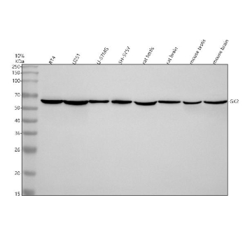 Western blot analysis of GK2 using anti-GK2 antibody. Electrophoresis was performed on a 10% SDS-PAGE gel at 80V (Stacking gel) / 120V (Resolving gel) for 2 hours. Lane 1: human RT4 whole cell lysates, Lane 2: human U251 whole cell lysates, Lane 3: human U-87MG whole cell lysates, Lane 4: human SH-SY5Y whole cell lysates, Lane 5: rat testis tissue lysates, Lane 6: rat brain tissue lysates, Lane 7: mouse testis tissue lysates, Lane 8: mouse brain tissue lysates. After electrophoresis, proteins were transferred to a nitrocellulose membrane at 150 mA for 50-90 minutes. Blocked the membrane with 5% non-fat milk/TBS for 1.5 hour at RT. The membrane was incubated with rabbit anti-GK2 antibody at 0.5 ug/ml overnight at 4oC, then washed with TBS-0.1%Tween 3 times with 5 minutes each and probed with a goat anti-rabbit IgG-HRP secondary antibody at a dilution of 1:5000 for 1.5 hour at RT. The signal was developed using an ECL Plus Western Blotting Substrate. A specific band was detected for GK2 at approximately 61 kDa. The expected band size for GK2 is at 61 kDa.