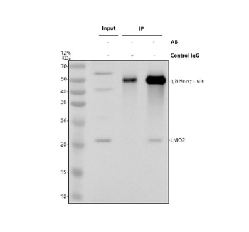 Immunoprecipitating (IP) LMO2 in K562 whole cell lysate. Western blot analysis of LMO2 using anti-LMO2 antibody; Lane 1: K562 whole cell lysates (30ug); Lane 2: Rabbit control IgG instead of anti-LMO2 antibody in K562 whole cell lysate; Lane 3: anti-LMO2 antibody (2ug) + K562 whole cell lysate (500ug). After electrophoresis, proteins were transferred to a membrane. Then the membrane was incubated with rabbit anti-LMO2 antibody at a dilution of 0.5 ug/ml and probed with a goat anti-rabbit IgG-HRP secondary antibody. The signal is developed using ECL Plus Western Blotting Substrate. The expected band size for LMO2 is at 18 kDa.