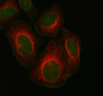 Immunofluorescent staining of FOXM1 using anti-FOXM1 antibody (green) and anti-Beta Tubulin antibody (red). FOXM1 was detected in immunocytochemical section of HELA cell. Enzyme antigen retrieval was performed using IHC enzyme antigen retrieval reagent for 15 mins. The cells were blocked with 10% goat serum. And then incubated with 5 ug/ml rabbit anti-FOXM1 antibody and mouse anti-Beta Tubulin antibody overnight at 4oC. DyLight 488 Conjugated Goat Anti-Rabbit IgG and DyLight 550 Conjugated Goat Anti-Mouse IgG were used as secondary antibody at 1:500 dilution and incubated for 30 minutes at 37oC. Visualize using a fluorescence microscope and filter sets appropriate for the label used.