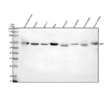 GBP1 Antibody Multi-Species WB. Western blot analysis of human placenta tissue lysate, human HUVEC whole cell lysate, human MCF-7 whole cell lysate, human HeLa whole cell lysate, rat brain tissue lysate, rat spleen tissue lysate, mouse brain tissue lysate, and mouse spleen tissue lysate using GBP1 antibody demonstrates a distinct band at approximately 68 kDa, consistent with the expected molecular weight of Guanylate binding protein 1 / GBP1. The observed cross-species expression profile supports the role of GBP1 as an interferon-induced GTPase involved in innate immune signaling, inflammatory activation, and host defense-associated pathways. Detection was performed using rabbit anti-GBP1 antibody followed by HRP-conjugated goat anti-rabbit secondary antibody and enhanced chemiluminescent development.