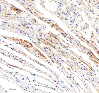 GBP1 Antibody Mouse Heart IHC. Immunohistochemistry analysis of paraffin-embedded mouse heart tissue stained with GBP1 antibody demonstrates cytoplasmic HRP-DAB brown staining within cardiomyocyte-associated and stromal cellular populations, consistent with interferon-responsive GBP1 expression in inflammatory and stress-associated tissue environments. The staining profile aligns with the role of Guanylate binding protein 1 / GBP1 as an innate immune-associated large GTPase involved in cytokine-responsive signaling pathways. Heat mediated antigen retrieval was performed in EDTA buffer (pH 8.0).