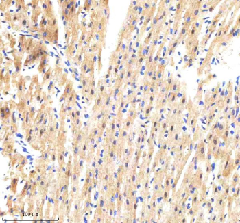 GBP1 Antibody Rat Heart IHC. Immunohistochemistry analysis of paraffin-embedded rat heart tissue stained with GBP1 antibody demonstrates diffuse cytoplasmic HRP-DAB brown staining within cardiomyocyte-associated cellular populations, consistent with the role of Guanylate binding protein 1 / GBP1 in interferon-responsive inflammatory signaling and stress-associated innate immune pathways. The observed staining pattern supports the established function of GBP1 as an interferon-inducible host defense GTPase involved in immune-associated cellular activation. Heat mediated antigen retrieval was performed in EDTA buffer (pH 8.0).