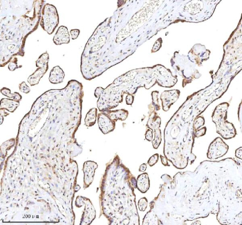 Immunohistochemical staining of RLIM using anti-RLIM antibody. RLIM was detected in a paraffin-embedded section of human placenta tissue. Heat mediated antigen retrieval was performed in EDTA buffer (pH 8.0, epitope retrieval solution). The tissue section was blocked with 10% goat serum. The tissue section was then incubated with 2 ug/ml rabbit anti-RLIM antibody overnight at 4oC. Peroxidase Conjugated Goat Anti-rabbit IgG was used as secondary antibody and incubated for 30 minutes at 37oC. The tissue section was developed using an HRP secondary and DAB substrate.