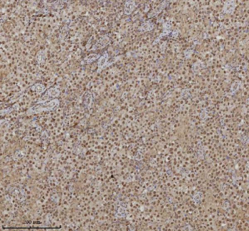 Immunohistochemical staining of RLIM using anti-RLIM antibody. RLIM was detected in a paraffin-embedded section of human testicular seminoma tissue. Heat mediated antigen retrieval was performed in EDTA buffer (pH 8.0, epitope retrieval solution). The tissue section was blocked with 10% goat serum. The tissue section was then incubated with 2 ug/ml rabbit anti-RLIM antibody overnight at 4oC. Peroxidase Conjugated Goat Anti-rabbit IgG was used as secondary antibody and incubated for 30 minutes at 37oC. The tissue section was developed using an HRP secondary and DAB substrate.