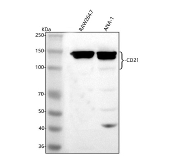 CR2 Antibody Macrophage Cell Line WB. Western blot analysis of Complement Receptor 2 / CD21 in mouse RAW264.7 and ANA-1 whole cell lysates using rabbit anti-CD21 antibody. A prominent band is detected at approximately 130â150 kDa in both lanes, consistent with glycosylated CD21, which migrates above its predicted molecular weight of approximately 110-120 kDa due to post-translational modification and isoform variation of this complement receptor.