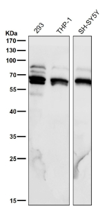 All lanes use the Phospho-p70 S6 Kinase beta (pSer371) antibody at 1:6000 dilution for 1 hour at room temperature.
