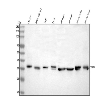 Western blot analysis of Syntaxin 12/STX12 using anti-STX12 antibody. Lane 1: human LNCAP whole cell lysates, Lane 2: human MDA-MB-453 whole cell lysates, Lane 3: human 293T whole cell lysates, Lane 4: human PC-3 whole cell lysates, Lane 5: rat brain tissue lysates, Lane 6: rat heart tissue lysates, Lane 7: mouse brain tissue lysates, Lane 8: mouse heart tissue lysates. After electrophoresis, proteins were transferred to a nitrocellulose membrane at 150 mA for 50-90 minutes. Blocked the membrane with 5% non-fat milk/TBS for 1.5 hour at RT. The membrane was incubated with rabbit anti-STX12 antibody at 0.5 ug/ml overnight at 4oC, then washed with TBS-0.1%Tween 3 times with 5 minutes each and probed with a goat anti-rabbit IgG-HRP secondary antibody at a dilution of 1:5000 for 1.5 hour at RT. The signal was developed using enhanced chemiluminescent. The predicted band size for STX12 is at 32 kDa, commonly observed at 32-37 kDa.