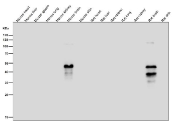 All lanes use the Phospho-MAP2 (pSer136) antibody at 1:1K dilution for 1 hour at room temperature. Phospho-MAP2 (pSer136) signal was detected only in brain lysates, consistent with MAP2 being a neuron-specific protein that is naturally phosphorylated in neural tissue and absent from non-neural organs such as liver, spleen, lung, kidney, and skin.
