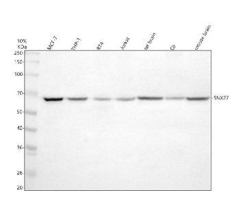 Western blot analysis of SNX27 using anti-SNX27 antibody. Electrophoresis was performed on a 10% SDS-PAGE gel at 80V (Stacking gel) / 120V (Resolving gel) for 2 hours. Lane 1: human MCF-7 whole cell lysates, Lane 2: human THP-1 whole cell lysates, Lane 3: human RT4 whole cell lysates, Lane 4: human Jurkat whole cell lysates, Lane 5: rat brain tissue lysates, Lane 6: rat C6 whole cell lysates, Lane 7: mouse brain tissue lysates. After electrophoresis, proteins were transferred to a nitrocellulose membrane at 150 mA for 50-90 minutes. Blocked the membrane with 5% non-fat milk/TBS for 1.5 hour at RT. The membrane was incubated with rabbit anti-SNX27 antibody at 0.5 ug/ml overnight at 4oC, then washed with TBS-0.1%Tween 3 times with 5 minutes each and probed with a goat anti-rabbit IgG-HRP secondary antibody at a dilution of 1:5000 for 1.5 hour at RT. The signal was developed using an ECL Plus Western Blotting Substrate. A specific band was detected for SNX27 at approximately 61 kDa. The expected band size for SNX27 is at 61 kDa.