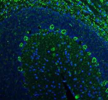 Immunofluorescent staining of YWHAH using anti-YWHAH antibody (green). YWHAH was detected in a paraffin-embedded section of rat cerebellum tissue. Heat mediated antigen retrieval was performed in EDTA buffer (pH 8.0, epitope retrieval solution). The tissue section was blocked with 10% goat serum. The tissue section was then incubated with 5 ug/ml rabbit anti-YWHAH antibody overnight at 4oC. DyLight 488 Conjugated Goat Anti-Rabbit IgG was used as secondary antibody at 1:500 dilution and incubated for 30 minutes at 37oC. The section was counterstained with DAPI nuclear stain (blue). Visualize using a fluorescence microscope and filter sets appropriate for the label used.
