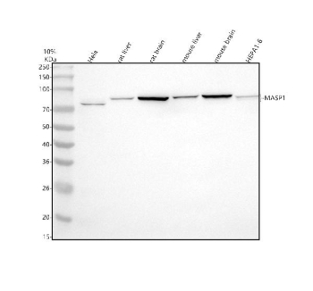 Western blot analysis of MASP1 using anti-MASP1 antibody. Electrophoresis was performed on a 10% SDS-PAGE gel at 80V (Stacking gel) / 120V (Resolving gel) for 2 hours. Lane 1: human Hela whole cell lysates, Lane 2: rat liver tissue lysates, Lane 3: rat brain tissue lysates, Lane 4: mouse liver tissue lysates, Lane 5: mouse brain tissue lysates, Lane 6: mouse HEPA1-6 whole cell lysates. After electrophoresis, proteins were transferred to a nitrocellulose membrane at 150 mA for 50-90 minutes. Blocked the membrane with 5% non-fat milk/TBS for 1.5 hour at RT. The membrane was incubated with rabbit anti-MASP1 antibody at 0.5 ug/ml overnight at 4oC, then washed with TBS-0.1%Tween 3 times with 5 minutes each and probed with a goat anti-rabbit IgG-HRP secondary antibody at a dilution of 1:5000 for 1.5 hour at RT. The signal was developed using an ECL Plus Western Blotting Substrate. A specific band was detected for MASP1 at approximately 79 kDa. The expected band size for MASP1 is at 79 kDa.