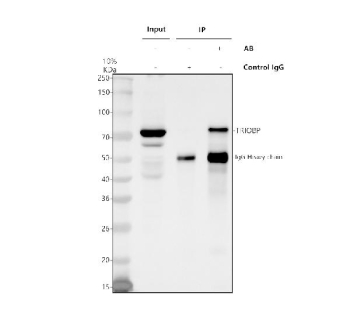 Immunoprecipitating TRIOBP in Hela whole cell lysate. Western blot analysis of TRIOBP using anti-TRIOBP antibody. Lane 1: Hela whole cell lysates (30ug), Lane 2: Rabbit control IgG instead of anti-TRIOBP antibody in Hela whole cell lysate, Lane 3: anti-TRIOBP antibody (2ug) + Hela whole cell lysate (500ug). After electrophoresis, proteins were transferred to a membrane. Then the membrane was incubated with rabbit anti-TRIOBP antibody at a dilution of 0.5 ug/ml and probed with a goat anti-rabbit IgG-HRP secondary antibody. The signal is developed using ECL Plus Western Blotting Substrate. A specific band was detected for TRIOBP at approximately 75 kDa. The expected band size for TRIOBP is at 261 kDa.