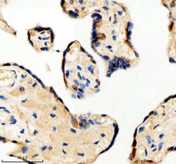 Immunohistochemical staining of PSMD1 using anti-PSMD1 antibody. PSMD1 was detected in a paraffin-embedded section of human placenta tissue. Heat mediated antigen retrieval was performed in EDTA buffer (pH 8.0, epitope retrieval solution). The tissue section was blocked with 10% goat serum. The tissue section was then incubated with 2 ug/ml rabbit anti-PSMD1 antibody overnight at 4oC. Peroxidase Conjugated Goat Anti-rabbit IgG was used as secondary antibody and incubated for 30 minutes at 37oC. The tissue section was developed using an HRP secondary and DAB substrate.