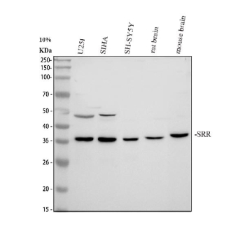 Western blot analysis of Serine racemase/ SRR using anti-Serine racemase antibody. Electrophoresis was performed on a 10% SDS-PAGE gel at 80V (Stacking gel) / 120V (Resolving gel) for 2-3 hours. Lane 1: human U251 whole cell lysates, Lane 2: human SiHa whole cell lysates, Lane 3: human SH-SY5Y whole cell lysates, Lane 4: rat brain tissue lysates, Lane 5: mouse brain tissue lysates. After electrophoresis, proteins were transferred to a nitrocellulose membrane at 150 mA for 50-90 minutes. Blocked the membrane with 5% non-fat milk/TBS for 1.5 hour at RT. The membrane was incubated with rabbit anti-Serine racemase antibody at 0.5 ug/ml overnight at 4oC, then washed with TBS-0.1%Tween 3 times with 5 minutes each and probed with a goat anti-rabbit IgG-HRP secondary antibody at a dilution of 1:5000 for 1.5 hour at RT. The signal was developed using an ECL Plus Western Blotting Substrate. A specific band was detected for Serine racemase at approximately 37 kDa. The expected band size for Serine racemase is at 37 kDa.