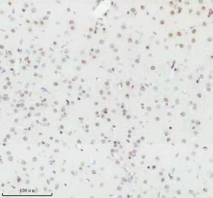 Histone H3 (Tri-Methyl K27) Antibody Rat Brain IHC. Immunohistochemical staining of FFPE rat brain tissue using Histone H3 (Tri-Methyl K27) Antibody / Epigenetic Histone Marker Antibody at a 1:50 dilution. An HRP-conjugated goat anti-rabbit IgG secondary antibody with DAB substrate was used for detection. Histone H3 (Tri-Methyl K27) Antibody demonstrates strong nuclear staining throughout the brain tissue, consistent with the nuclear localization of H3K27 trimethylation as an epigenetic marker associated with transcriptional repression.