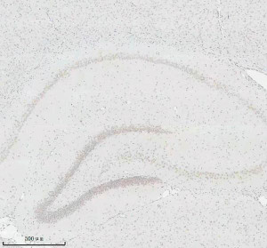 Histone H3 (Tri-Methyl K27) Antibody Rat Hippocampus IHC. Immunohistochemical staining of FFPE rat brain (hippocampus) tissue using Histone H3 (Tri-Methyl K27) Antibody / Epigenetic Histone Marker Antibody at a 1:50 dilution. An HRP-conjugated goat anti-rabbit IgG secondary antibody with DAB substrate was used for detection. Histone H3 (Tri-Methyl K27) Antibody demonstrates widespread nuclear staining throughout the hippocampal formation, consistent with the nuclear localization of H3K27 trimethylation as an epigenetic marker associated with transcriptional repression.