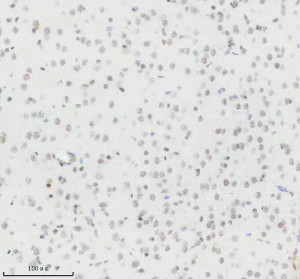 Histone H3 (Tri-Methyl K27) Antibody Mouse Brain IHC. Immunohistochemical staining of FFPE mouse brain tissue using Histone H3 (Tri-Methyl K27) Antibody / Epigenetic Histone Marker Antibody at a 1:50 dilution. An HRP-conjugated goat anti-rabbit IgG secondary antibody with DAB substrate was used for detection. Histone H3 (Tri-Methyl K27) Antibody demonstrates widespread nuclear staining throughout the brain tissue, consistent with the nuclear localization of H3K27 trimethylation as an epigenetic marker associated with transcriptional repression.