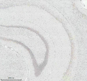 Histone H3 (Tri-Methyl K27) Antibody Mouse Hippocampus IHC. Immunohistochemical staining of FFPE mouse brain (hippocampus) tissue using Histone H3 (Tri-Methyl K27) Antibody / Epigenetic Histone Marker Antibody at a 1:50 dilution. An HRP-conjugated goat anti-rabbit IgG secondary antibody with DAB substrate was used for detection. Histone H3 (Tri-Methyl K27) Antibody demonstrates widespread nuclear staining throughout the hippocampal formation, consistent with the nuclear localization of H3K27 trimethylation as an epigenetic marker associated with transcriptional repression.