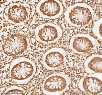 Immunohistochemical staining of NUP43 using anti-NUP43 antibody. NUP43 was detected in a paraffin-embedded section of human colon tissue. Heat mediated antigen retrieval was performed in EDTA buffer (pH 8.0, epitope retrieval solution). The tissue section was blocked with 10% goat serum. The tissue section was then incubated with 2 ug/ml rabbit anti-NUP43 antibody overnight at 4oC. Peroxidase Conjugated Goat Anti-rabbit IgG was used as secondary antibody and incubated for 30 minutes at 37oC. The tissue section was developed using an HRP secondary and DAB substrate.