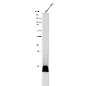 Histone H2B Formyl K116 Antibody for WB. All lanes use the Histone H2B (formyl K116) antibody at 1:5K dilution for 1 hour at room temperature.