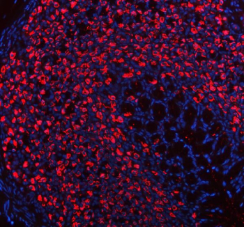 Immunofluorescent staining of ATP4B using anti-ATP4B antibody (red). ATP4B was detected in a paraffin-embedded section of mouse stomach tissue. Heat mediated antigen retrieval was performed in EDTA buffer (pH 8.0, epitope retrieval solution). The tissue section was blocked with 10% goat serum. The tissue section was then incubated with 5 ug/ml rabbit anti-ATP4B antibody overnight at 4oC. DyLight 594 Conjugated Goat Anti-Rabbit IgG was used as secondary antibody at 1:500 dilution and incubated for 30 minutes at 37oC. The section was counterstained with DAPI nuclear stain (blue). Visualize using a fluorescence microscope and filter sets appropriate for the label used.