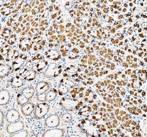 ATP4B Antibody Human Stomach IHC. Immunohistochemical staining of FFPE human stomach tissue using ATP4B antibody at 2 ug/ml. An HRP-conjugated goat anti-rabbit IgG secondary antibody with DAB substrate was used for detection. ATP4B antibody demonstrates strong cytoplasmic and membranous staining of gastric parietal cells, while adjacent gastric glandular cells show little to no immunoreactivity.