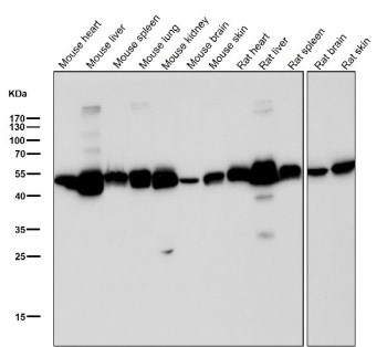 ALDH2 Antibody Multi-Species Tissue WB. Western blot analysis of ALDH2 expression was performed using ALDH2 antibody clone 31A72 in a panel of mouse and rat tissue lysates. Samples include mouse heart, liver, spleen, lung, kidney, brain, skin, as well as rat heart, liver, spleen, brain, and skin. ALDH2, also known as Aldehyde Dehydrogenase 2, is a mitochondrial enzyme that catalyzes the oxidation of reactive aldehydes generated during alcohol metabolism, lipid peroxidation, and oxidative stress. A prominent immunoreactive band is detected at approximately 56 kDa across multiple tissues, corresponding to the expected molecular weight of ALDH2. The widespread expression observed is consistent with the essential role of ALDH2 in mitochondrial detoxification and metabolic homeostasis throughout diverse organ systems. All lanes were probed with ALDH2 antibody clone 31A72 at a 1:3000 dilution for 1 hour at room temperature. These results support the utility of ALDH2 Antibody for studies of aldehyde metabolism, mitochondrial biology, oxidative stress responses, and tissue-specific metabolic regulation.