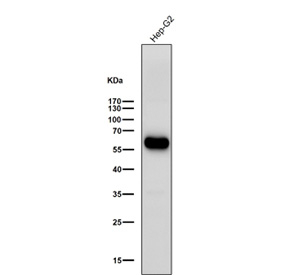 ALDH2 Antibody HepG2 WB. Western blot analysis of ALDH2 expression was performed using anti-ALDH2 antibody in human HepG2 cell lysate. ALDH2, also known as Aldehyde Dehydrogenase 2, is a mitochondrial enzyme that catalyzes the detoxification of reactive aldehydes generated during alcohol metabolism, lipid peroxidation, and oxidative stress. A strong immunoreactive band is detected at approximately 56 kDa, corresponding to the predicted molecular weight of ALDH2. Robust expression in HepG2 hepatocellular carcinoma cells is consistent with the important role of ALDH2 in hepatic aldehyde metabolism and mitochondrial detoxification pathways. The blot was probed with ALDH2 antibody at a 1:3000 dilution for 1 hour at room temperature. These results support the utility of ALDH2 Antibody for studies of aldehyde metabolism, mitochondrial function, oxidative stress responses, and liver biology.