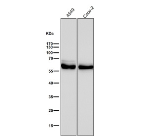 ALDH2 Antibody A549 and Caco-2 WB. Western blot analysis of ALDH2 expression was performed using anti-ALDH2 antibody in human A549 and Caco-2 cell lysates. ALDH2, also known as Aldehyde Dehydrogenase 2, is a mitochondrial enzyme that catalyzes the oxidation and detoxification of reactive aldehydes generated during alcohol metabolism, lipid peroxidation, and oxidative stress. Lane 1: A549 lysate. Lane 2: Caco-2 lysate. A prominent immunoreactive band is detected at approximately 56 kDa in both cell lines, corresponding to the expected molecular weight of ALDH2. Expression in lung carcinoma-derived A549 cells and intestinal epithelial-derived Caco-2 cells is consistent with the widespread requirement for mitochondrial aldehyde detoxification and cellular protection against oxidative damage. All lanes were probed with ALDH2 antibody at a 1:3000 dilution for 1 hour at room temperature. These results support the utility of ALDH2 Antibody for studies of aldehyde metabolism, mitochondrial function, oxidative stress responses, and cellular detoxification pathways.