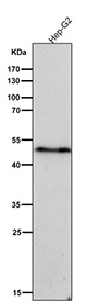 All lanes use the Phospho-VASP (pSer156) antibody at 1:5000 dilution for 1 hour at room temperature.