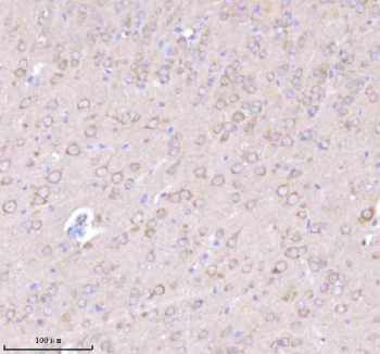 Immunohistochemical staining of NRTN using anti-NRTN antibody. NRTN was detected in a paraffin-embedded section of mouse brain tissue. Heat mediated antigen retrieval was performed in EDTA buffer (pH 8.0, epitope retrieval solution). The tissue section was blocked with 10% goat serum. The tissue section was then incubated with 2 ug/ml rabbit anti-NRTN antibody overnight at 4oC. Peroxidase Conjugated Goat Anti-rabbit IgG was used as secondary antibody and incubated for 30 minutes at 37oC. The tissue section was developed using an HRP secondary and DAB substrate.