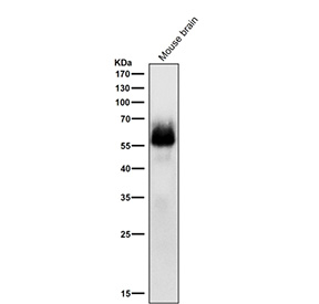 Western blot testing of mouse brain tissue lysate with Phospho-Chk2 (pSer33/pSer35) antibody at 1:1000 dilution for 1 hour at room temperature. Predicted molecular weight ~61 kDa.