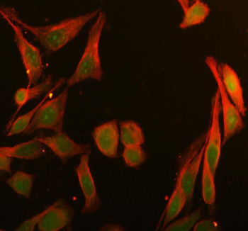 Immunofluorescent staining of BRD1 using anti-BRD1 antibody (green) and anti-Beta Tubulin antibody (red). BRD1 was detected in immunocytochemical section of HELA cell. Enzyme antigen retrieval was performed using IHC enzyme antigen retrieval reagent for 15 mins. The cells were blocked with 10% goat serum. And then incubated with 5 ug/ml rabbit anti-BRD1 antibody and mouse anti-Beta Tubulin antibody overnight at 4oC. DyLight 488 Conjugated Goat Anti-Rabbit IgG and Cy3 Conjugated Goat Anti-Mouse IgG were used as secondary antibody at 1:500 dilution and incubated for 30 minutes at 37oC. Visualize using a fluorescence microscope and filter sets appropriate for the label used.