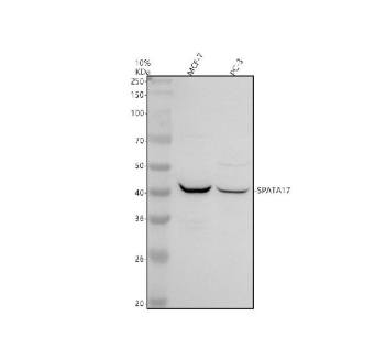 Western blot analysis of SPATA17 using anti-SPATA17 antibody. Electrophoresis was performed on a 10% SDS-PAGE gel at 80V (Stacking gel) / 120V (Resolving gel) for 2 hours. Lane 1: human MCF-7 whole cell lysates, Lane 2: human PC-3 whole cell lysates. After electrophoresis, proteins were transferred to a nitrocellulose membrane at 150 mA for 50-90 minutes. Blocked the membrane with 5% non-fat milk/TBS for 1.5 hour at RT. The membrane was incubated with rabbit anti-SPATA17 antibody at 0.5 ug/ml overnight at 4oC, then washed with TBS-0.1%Tween 3 times with 5 minutes each and probed with a goat anti-rabbit IgG-HRP secondary antibody at a dilution of 1:5000 for 1.5 hour at RT. The signal was developed using an ECL Plus Western Blotting Substrate. The predicted molecular weight of SPATA17 is ~43 kDa.
