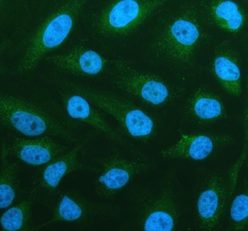 Immunofluorescent staining of P2RX1 using anti-P2RX1 antibody (green). P2RX1 was detected in an immunocytochemical section of HELA cells. Enzyme antigen retrieval was performed using IHC enzyme antigen retrieval reagent for 15 mins. The cells were blocked with 10% goat serum. And then incubated with 5 ug/ml rabbit anti-P2RX1 antibody overnight at 4oC. DyLight 488 Conjugated Goat Anti-Rabbit IgG was used as secondary antibody at 1:500 dilution and incubated for 30 minutes at 37oC. The section was counterstained with DAPI nuclear stain (blue). Visualize using a fluorescence microscope and filter sets appropriate for the label used.