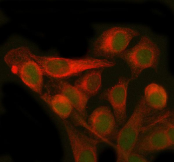 Immunofluorescent staining of PMM2 using anti-PMM2 antibody (green) and anti-Beta Tubulin antibody (red). PMM2 was detected in immunocytochemical section of HELA cell. Enzyme antigen retrieval was performed using IHC enzyme antigen retrieval reagent for 15 mins. The cells were blocked with 10% goat serum. And then incubated with 5 ug/ml rabbit anti-PMM2 antibody and mouse anti-Beta Tubulin antibody overnight at 4oC. DyLight 488 Conjugated Goat Anti-Rabbit IgG and Cy3 Conjugated Goat Anti-Mouse IgG were used as secondary antibody at 1:500 dilution and incubated for 30 minutes at 37oC. Visualize using a fluorescence microscope and filter sets appropriate for the label used.