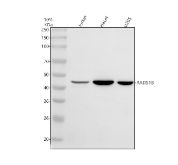 Western blot analysis of RAD51B using anti-RAD51B antibody. Electrophoresis was performed on a 10% SDS-PAGE gel at 80V (Stacking gel) / 120V (Resolving gel) for 2 hours. Lane 1: human Jurkat whole cell lysates, Lane 2: human Hacat whole cell lysates, Lane 3: human U20S whole cell lysates. After electrophoresis, proteins were transferred to a nitrocellulose membrane at 150 mA for 50-90 minutes. Blocked the membrane with 5% non-fat milk/TBS for 1.5 hour at RT. The membrane was incubated with rabbit anti-RAD51B antibody at 0.5 ug/ml overnight at 4oC, then washed with TBS-0.1%Tween 3 times with 5 minutes each and probed with a goat anti-rabbit IgG-HRP secondary antibody at a dilution of 1:5000 for 1.5 hour at RT. The signal was developed using an ECL Plus Western Blotting Substrate. The expected molecular weight of RAD51B is ~42 kDa.