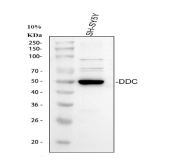 Western blot analysis of DDC using anti-DDC antibody. Electrophoresis was performed on a 10% SDS-PAGE gel at 80V (Stacking gel) / 120V (Resolving gel) for 2 hours. Lane 1: human SHSY-5Y whole cell lysates, Lane 2: human Caco-2 whole cell lysates, Lane 3: human HepG2 whole cell lysates, Lane 4: rat NRK whole cell lysates, Lane 5: rat PC-12 whole cell lysates, Lane 6: mouse kidney tissue lysates. After electrophoresis, proteins were transferred to a nitrocellulose membrane at 150 mA for 50-90 minutes. Blocked the membrane with 5% non-fat milk/TBS for 1.5 hour at RT. The membrane was incubated with rabbit anti-DDC antibody at 0.5 ug/ml overnight at 4oC, then washed with TBS-0.1%Tween 3 times with 5 minutes each and probed with a goat anti-rabbit IgG-HRP secondary antibody at a dilution of 1:5000 for 1.5 hour at RT. The signal was developed using an ECL Plus Western Blotting Substrate. The expected molecular weight of DDC is ~54 kDa.