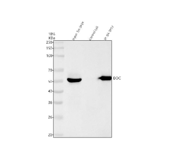 Immunoprecipitation of DDC in SH-SY5Y whole cell lysate. Western blot analysis of DDC using anti-DDC antibody; Lane 1: SH-SY5Y whole cell lysates (30ug); Lane 2: Rabbit control IgG instead of anti-DDC antibody in SH-SY5Y whole cell lysate; Lane 3: anti-DDC antibody (2ug) + SH-SY5Y whole cell lysate (500ug). After electrophoresis, proteins were transferred to a membrane. Then the membrane was incubated with rabbit anti-DDC antibody at a dilution of 0.5 ug/ml and probed with a goat anti-rabbit IgG-HRP secondary antibody. The signal is developed using ECL Plus Western Blotting Substrate. The expected molecular weight of DDC is ~54 kDa.