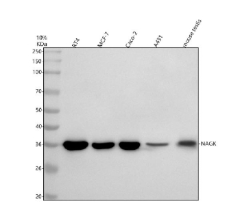 Western blot analysis of NAGK using anti-NAGK antibody. Electrophoresis was performed on a 10% SDS-PAGE gel at 80V (Stacking gel) / 120V (Resolving gel) for 2 hours. Lane 1: human RT4 whole cell lysates, Lane 2: human MCF-7 whole cell lysates, Lane 3: human Caco-2 whole cell lysates, Lane 4: human whole cell lysates. Lane 5: mouse testis tissue lysates. After electrophoresis, proteins were transferred to a nitrocellulose membrane at 150 mA for 50-90 minutes. Blocked the membrane with 5% non-fat milk/TBS for 1.5 hour at RT. The membrane was incubated with rabbit anti-NAGK antibody at 0.5 ug/ml overnight at 4oC, then washed with TBS-0.1%Tween 3 times with 5 minutes each and probed with a goat anti-rabbit IgG-HRP secondary antibody at a dilution of 1:5000 for 1.5 hour at RT. The signal was developed using an ECL Plus Western Blotting Substrate. The expected molecular weight of NAGK is ~37 kDa.