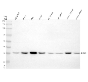 SNX20 Antibody Human/Mouse/Rat Sample WB. Western blot analysis of SNX20 using anti-SNX20 antibody. Electrophoresis was performed on a 10% SDS-PAGE gel at 80V (Stacking gel) / 120V (Resolving gel) for 2 hours. Lane 1: human COLO-320 whole cell lysates, Lane 2: human THP-1 whole cell lysates, Lane 3: human HEL whole cell lysates, Lane 4: human Jurkat whole cell lysates, Lane 5: rat thymus tissue lysates, Lane 6: rat spleen tissue lysates, Lane 7: mouse thymus tissue lysates, Lane 8: mouse spleen tissue lysates. After electrophoresis, proteins were transferred to a nitrocellulose membrane at 150 mA for 50-90 minutes. Blocked the membrane with 5% non-fat milk/TBS for 1.5 hour at RT. The membrane was incubated with rabbit anti-SNX20 antibody at 0.5 ug/ml overnight at 4oC, then washed with TBS-0.1%Tween 3 times with 5 minutes each and probed with a goat anti-rabbit IgG-HRP secondary antibody at a dilution of 1:5000 for 1.5 hour at RT. The signal was developed using an ECL Plus Western Blotting Substrate. The expected molecular weight of SNX20 is ~36 kDa.