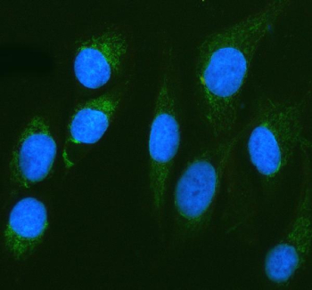Immunofluorescent staining of CAPN6 using anti-CAPN6 antibody (green). CAPN6 was detected in an immunocytochemical section of U2OS cells. Enzyme antigen retrieval was performed using IHC enzyme antigen retrieval reagent for 15 mins. The cells were blocked with 10% goat serum. And then incubated with 5 ug/ml rabbit anti-CAPN6 antibody overnight at 4oC. DyLight 488 Conjugated Goat Anti-Rabbit IgG was used as secondary antibody at 1:500 dilution and incubated for 30 minutes at 37oC. The section was counterstained with DAPI nuclear stain (blue). Visualize using a fluorescence microscope and filter sets appropriate for the label used.