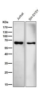 All lanes use the ACADVL antibody at 1:5K dilution for 1 hour at room temperature. Predicted molecular weight ~68 kDa.