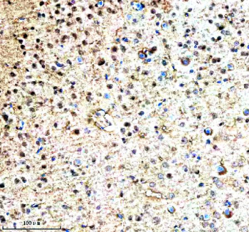 Immunohistochemical staining of RNF220 using anti-RNF220 antibody. RNF220 was detected in a paraffin-embedded section of mouse brain tissue. Heat mediated antigen retrieval was performed in EDTA buffer (pH 8.0, epitope retrieval solution). The tissue section was blocked with 10% goat serum. The tissue section was then incubated with 2 ug/ml rabbit anti-RNF220 antibody overnight at 4oC. Peroxidase Conjugated Goat Anti-rabbit IgG was used as secondary antibody and incubated for 30 minutes at 37oC. The tissue section was developed using an HRP secondary and DAB substrate.
