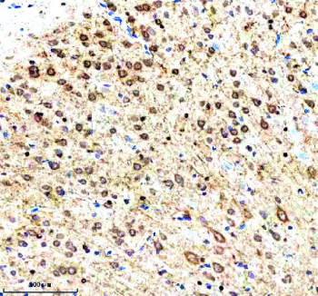 Immunohistochemical staining of RNF220 using anti-RNF220 antibody. RNF220 was detected in a paraffin-embedded section of rat brain tissue. Heat mediated antigen retrieval was performed in EDTA buffer (pH 8.0, epitope retrieval solution). The tissue section was blocked with 10% goat serum. The tissue section was then incubated with 2 ug/ml rabbit anti-RNF220 antibody overnight at 4oC. Peroxidase Conjugated Goat Anti-rabbit IgG was used as secondary antibody and incubated for 30 minutes at 37oC. The tissue section was developed using an HRP secondary and DAB substrate.