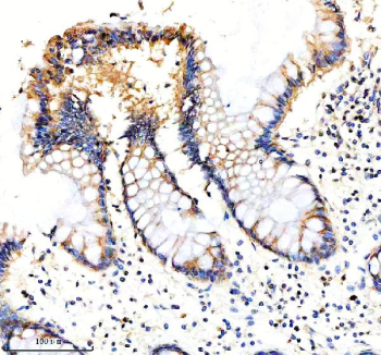 Immunohistochemical staining of EIF3H using anti-EIF3H antibody. EIF3H was detected in a paraffin-embedded section of human colon tissue. Heat mediated antigen retrieval was performed in EDTA buffer (pH 8.0, epitope retrieval solution). The tissue section was blocked with 10% goat serum. The tissue section was then incubated with 2 ug/ml rabbit anti-EIF3H antibody overnight at 4oC. Peroxidase Conjugated Goat Anti-rabbit IgG was used as secondary antibody and incubated for 30 minutes at 37oC. The tissue section was developed using an HRP secondary and DAB substrate.