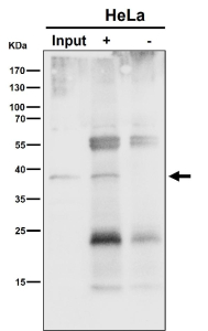 Immunoprecipitation analysis using the NSDHL antibody at 1:50 dilution. Western blot at 1:1000 dilution. NSDHL is an ER-associated membrane protein that typically migrates faster on SDS-PAGE due to signal peptide cleavage and altered SDS binding and is commonly observed at ~38 kDa.